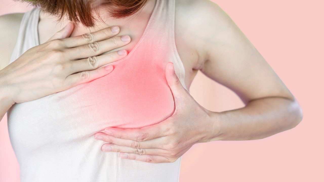 Image of a woman cupping her left breast