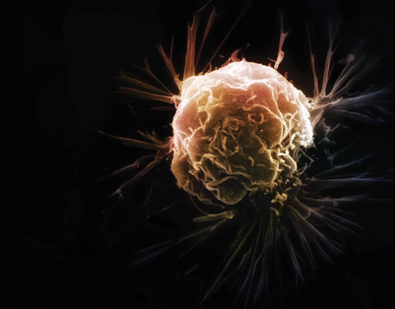 breast cancer treatment