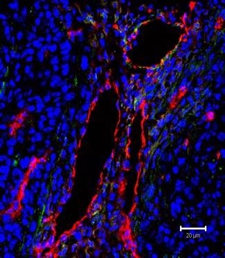 Endothelial staining