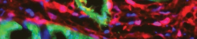 Cancer Cells